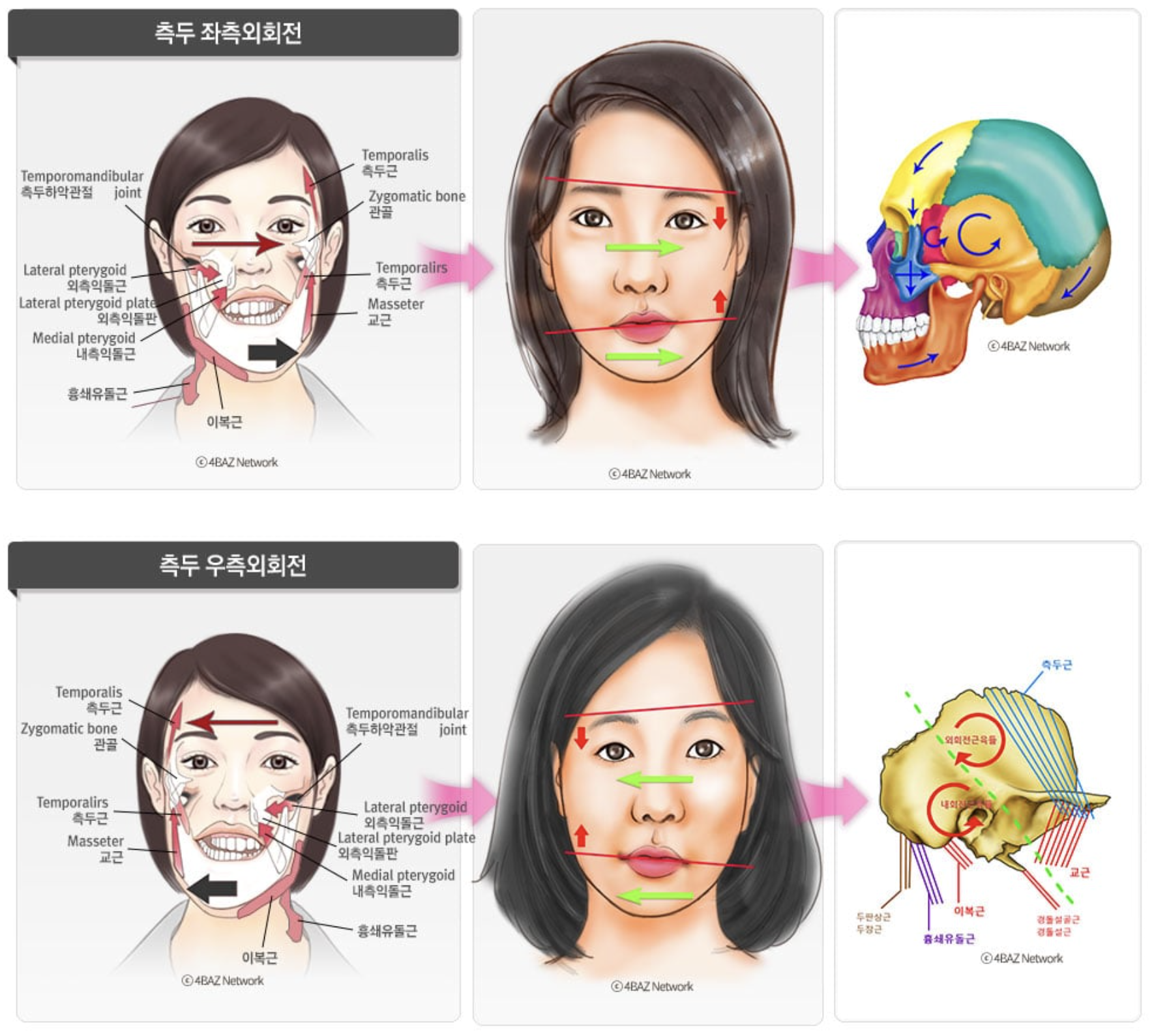 상·하악 같은 방향 유형